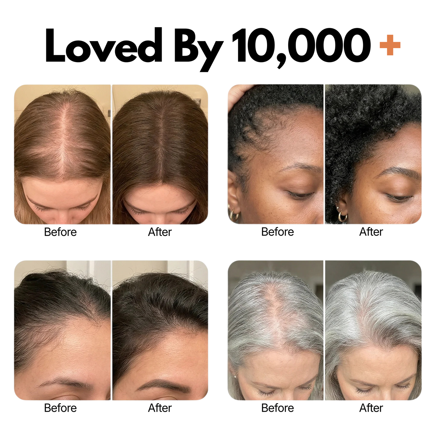 Korea's #1 Hair Growth Serum