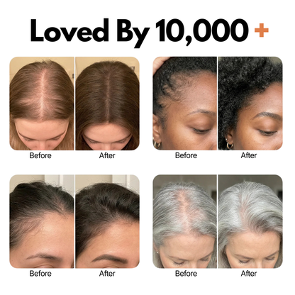 Korea's #1 Hair Growth Serum