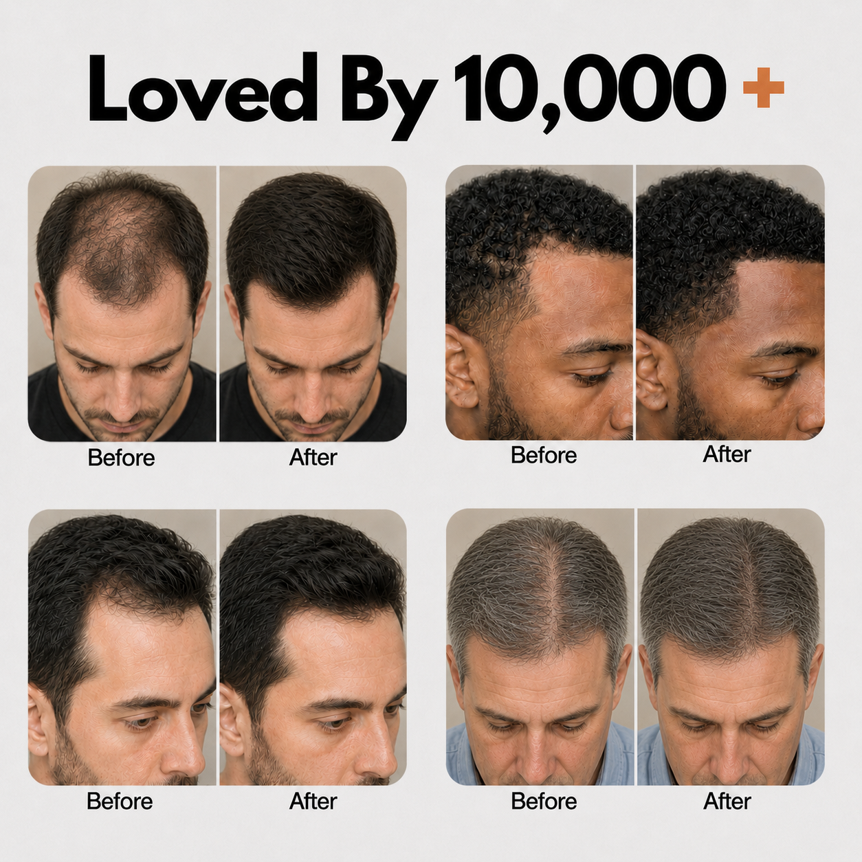Korea's #1 Hair Growth Serum (Copy for men)