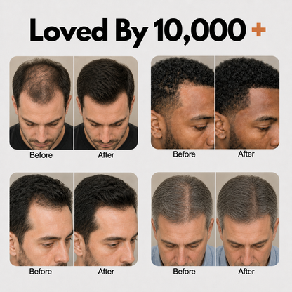 Korea's #1 Hair Growth Serum (Copy for men)