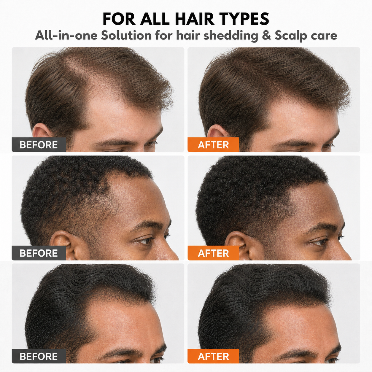 Korea's #1 Hair Growth Serum (Copy for men)