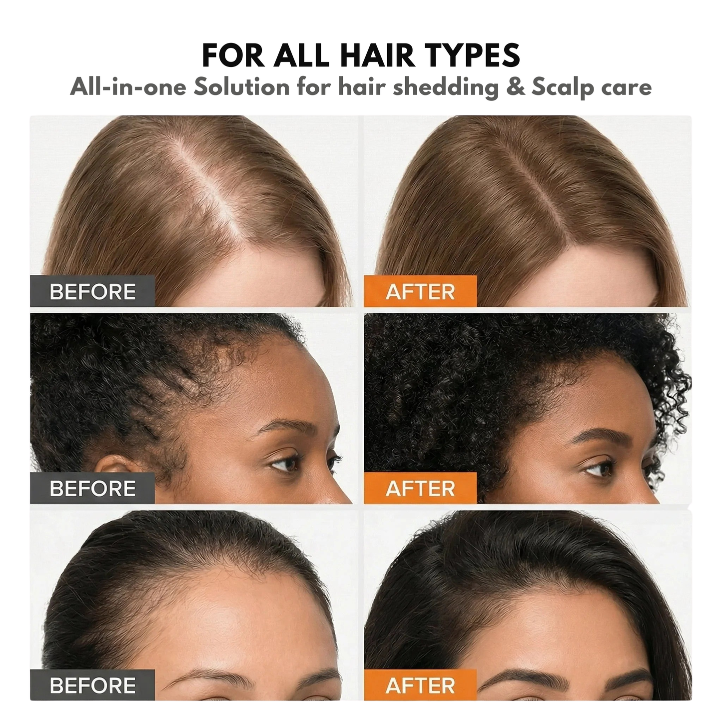 Korea's #1 Hair Growth Serum